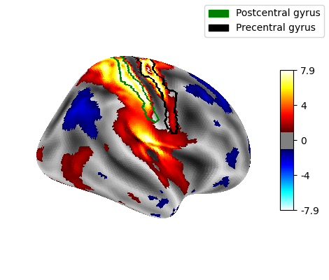 Surface right hemisphere