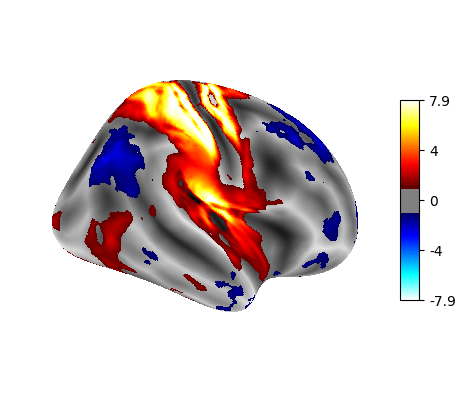 Surface right hemisphere: fine mesh