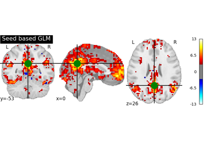 Default Mode Network extraction of ADHD dataset