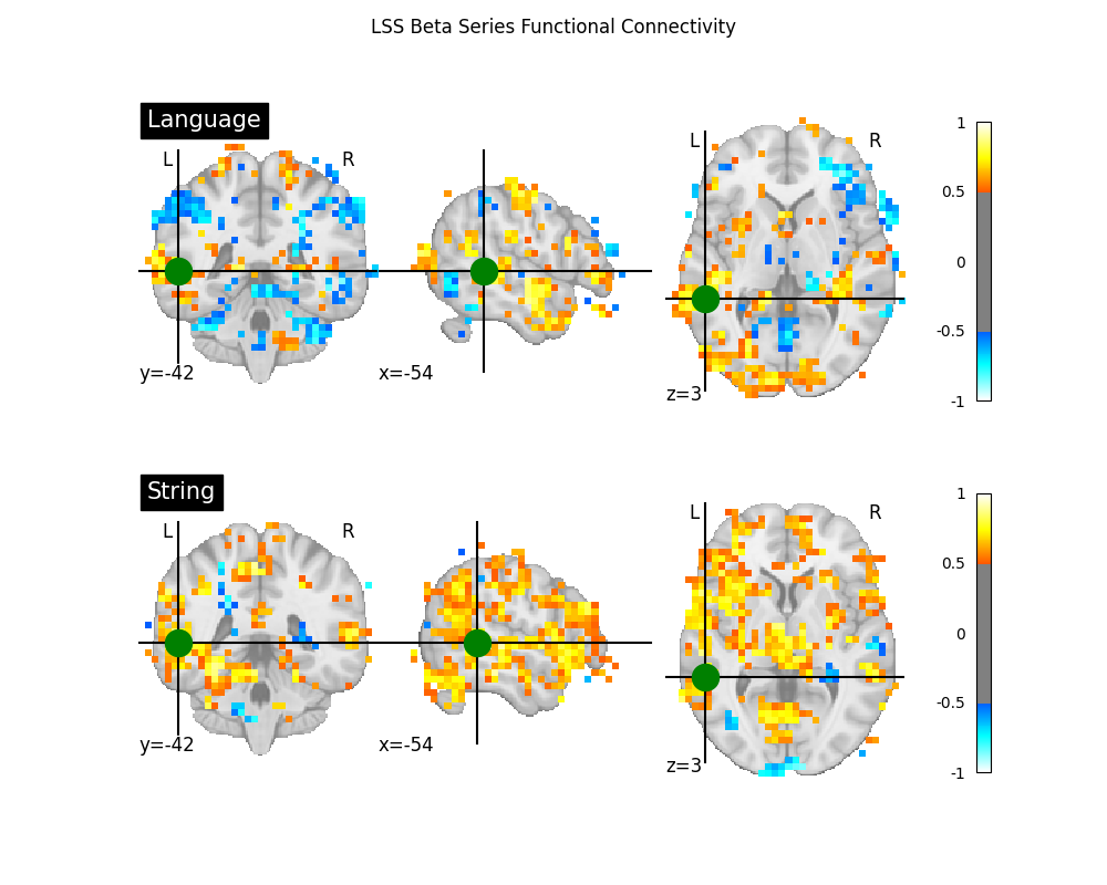 LSS Beta Series Functional Connectivity