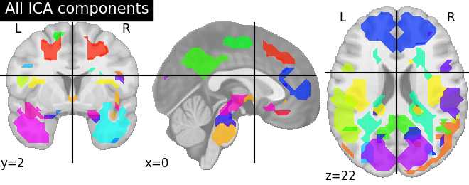 _images/sphx_glr_plot_compare_decomposition_001.png