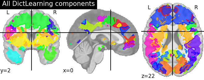 ../_images/sphx_glr_plot_compare_decomposition_022.png