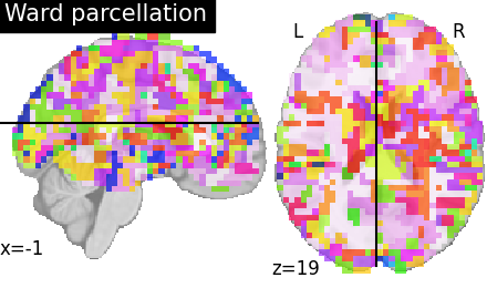 _images/sphx_glr_plot_data_driven_parcellations_001.png