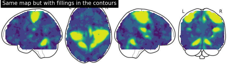 plot demo glass brain extensive