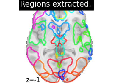 Regions Extraction of Default Mode Networks using Smith Atlas