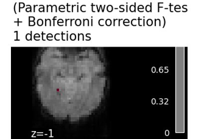 Massively univariate analysis of face vs house recognition