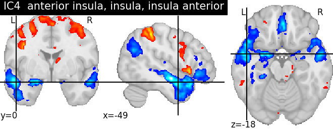 plot ica neurovault