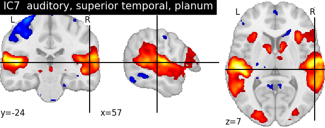 plot ica neurovault