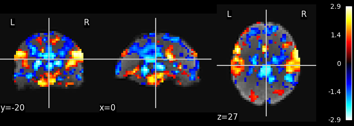 plot ica resting state