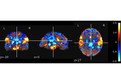 Multivariate decompositions: Independent component analysis of fMRI