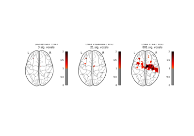 Massively univariate analysis of a motor task from the Localizer dataset