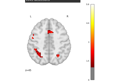 Massively univariate analysis of a calculation task from the Localizer dataset