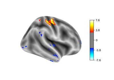 Example of surface-based first-level analysis