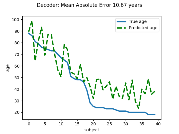 _images/sphx_glr_plot_oasis_vbm_002.png