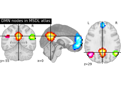 Visualizing a probabilistic atlas: the default mode in the MSDL atlas