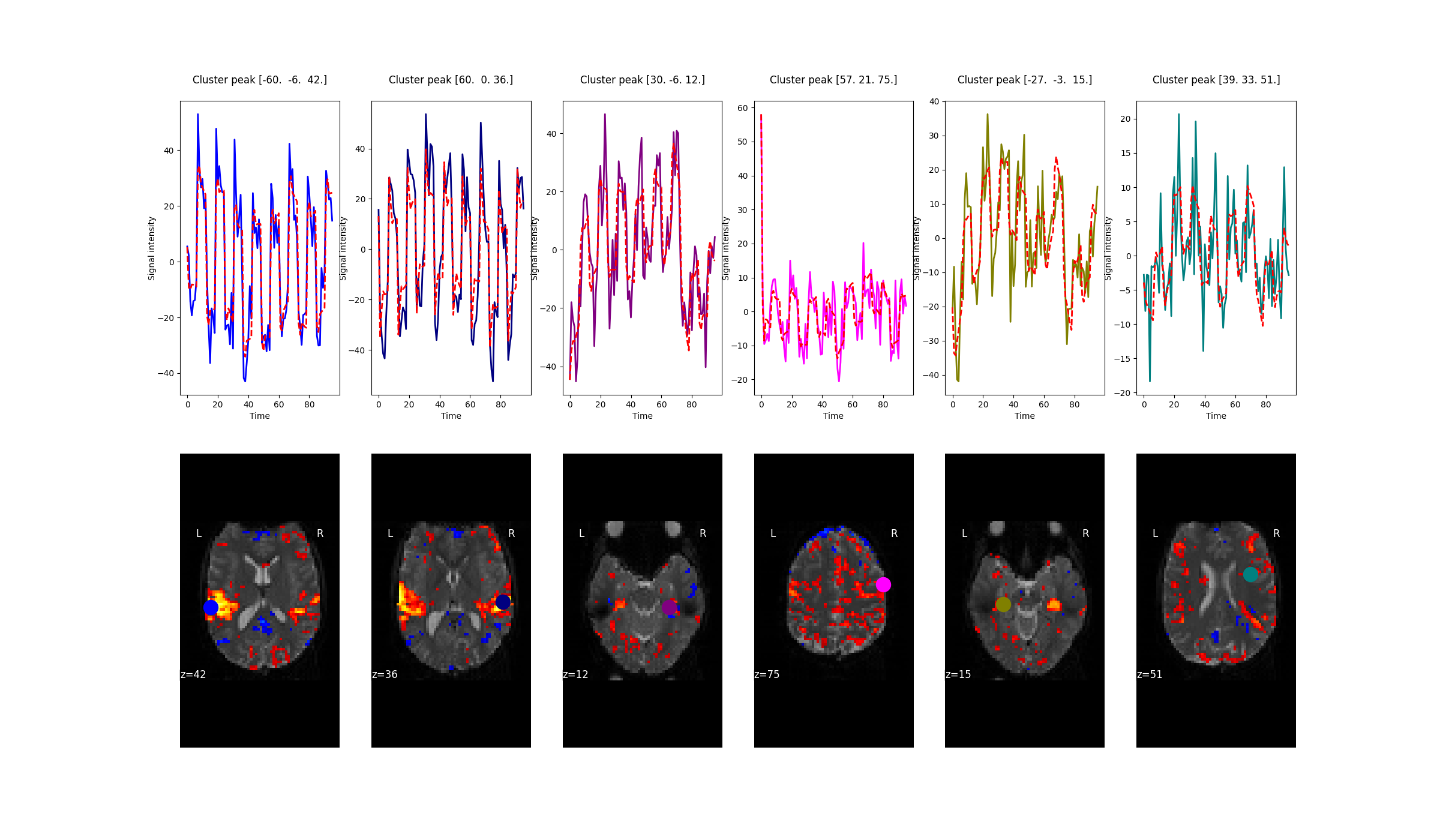 Cluster peak [-60.  -6.  42.] , Cluster peak [60.  0. 36.] , Cluster peak [30. -6. 12.] , Cluster peak [57. 21. 75.] , Cluster peak [-27.  -3.  15.] , Cluster peak [39. 33. 51.]