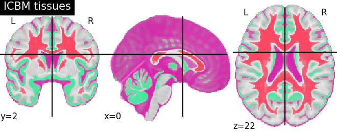 plot prob atlas