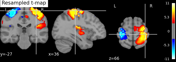 ../_images/sphx_glr_plot_resample_to_template_002.png