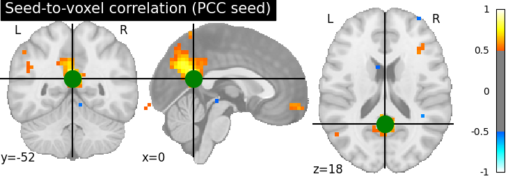 plot seed to voxel correlation