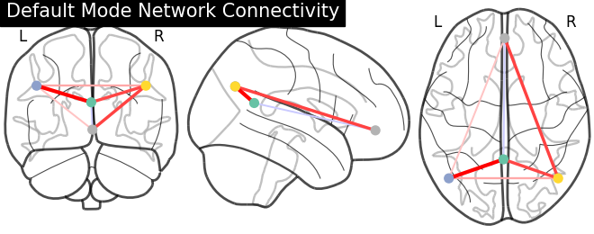 plot sphere based connectome