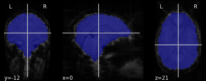 ../_images/sphx_glr_plot_visualization_002.png