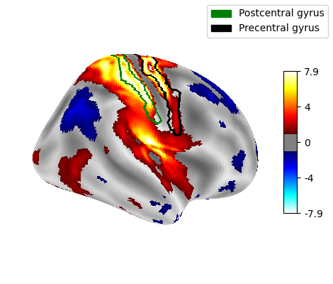 Surface right hemisphere