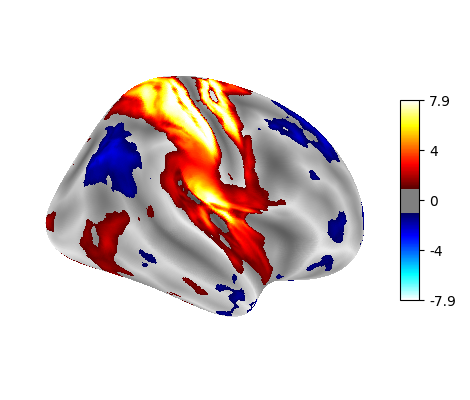 Surface right hemisphere: fine mesh