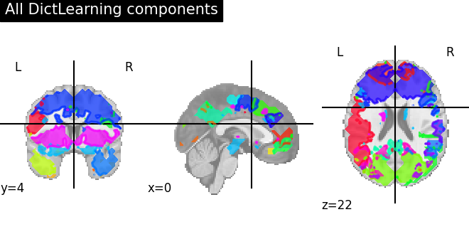 ../_images/sphx_glr_plot_compare_decomposition_022.png