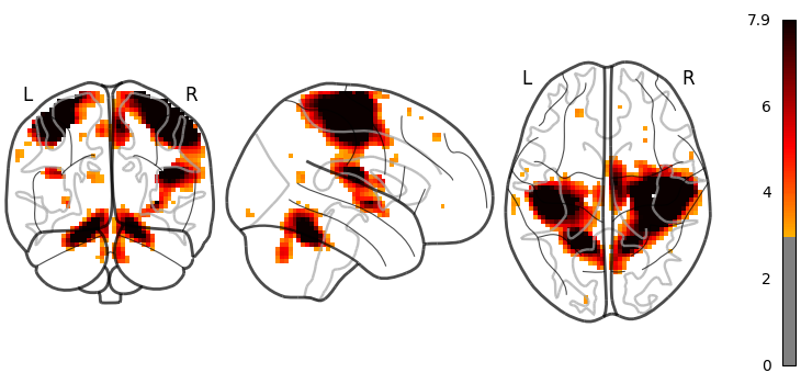 plot demo glass brain extensive