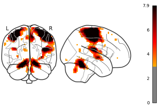 plot demo glass brain extensive