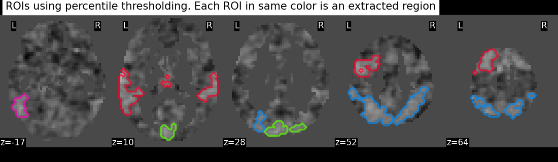 plot extract rois statistical maps