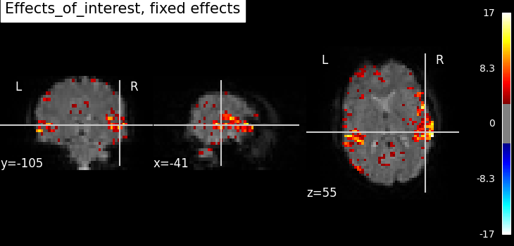 plot fiac analysis