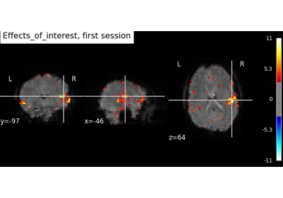 Simple example of two-session fMRI model fitting