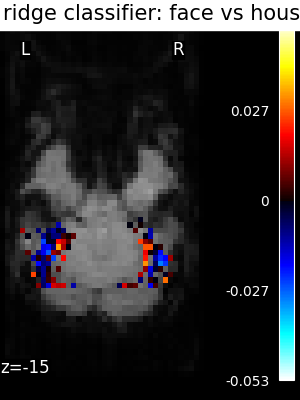 ../_images/sphx_glr_plot_haxby_different_estimators_004.png