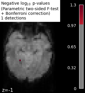 ../_images/sphx_glr_plot_haxby_mass_univariate_001.png