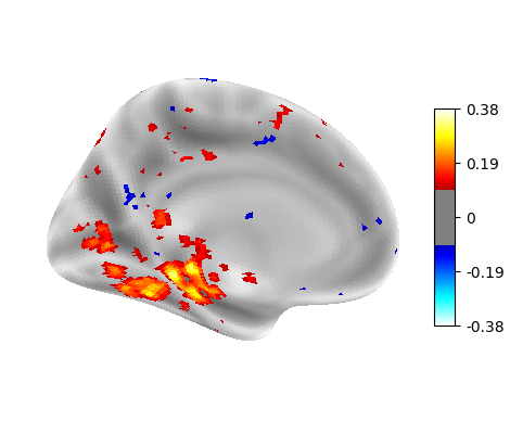 Accuracy map, left hemisphere