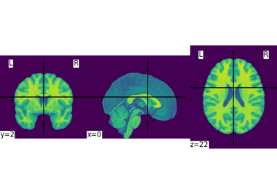 Basic nilearn example: manipulating and looking at data