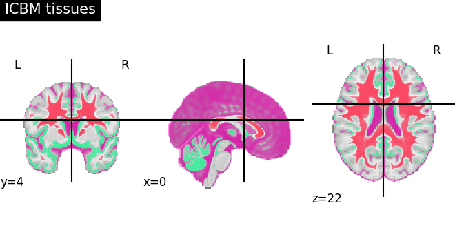 plot prob atlas