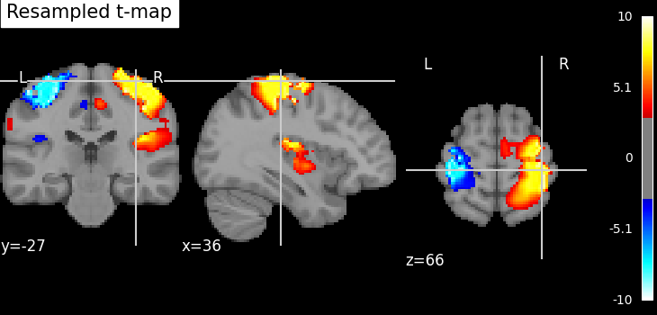 ../_images/sphx_glr_plot_resample_to_template_002.png