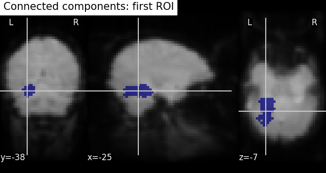 plot roi extraction