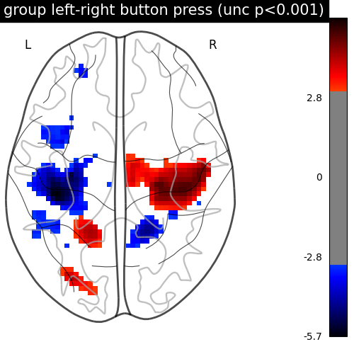 plot second level one sample test