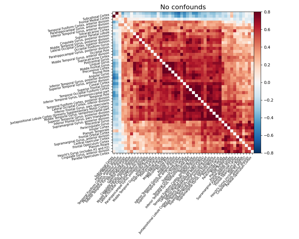 ../_images/sphx_glr_plot_signal_extraction_002.png