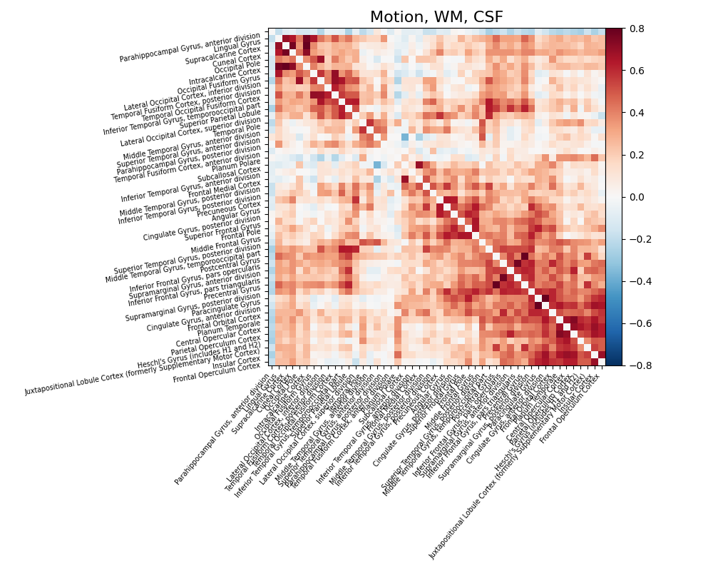 Motion, WM, CSF
