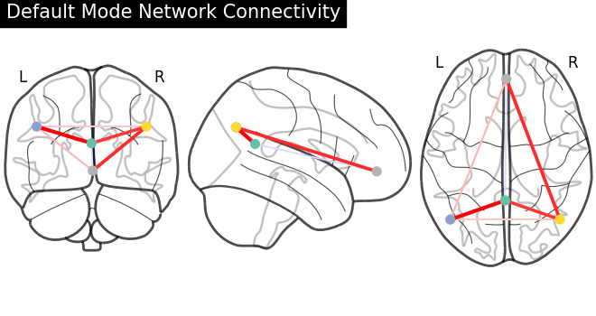 plot sphere based connectome