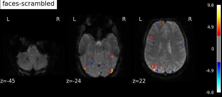 ../_images/sphx_glr_plot_spm_multimodal_faces_001.png