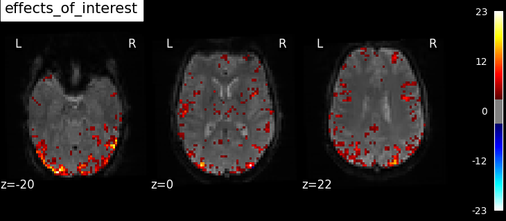 ../_images/sphx_glr_plot_spm_multimodal_faces_003.png