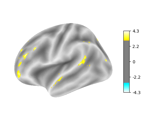 language-string, left hemisphere