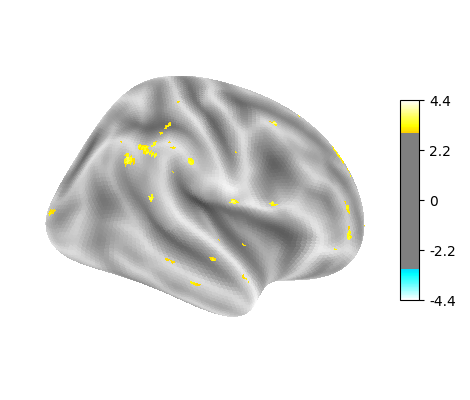 language-string, right hemisphere