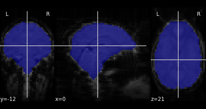 ../_images/sphx_glr_plot_visualization_002.png