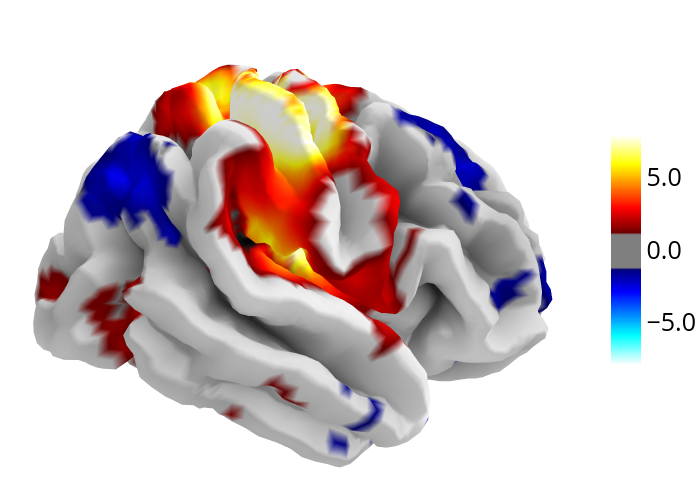 ../_images/plotly_plot_surf_stat_map.png